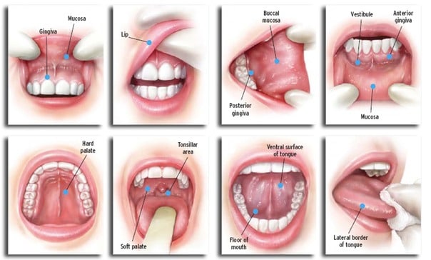 Oral cancer screening diagram