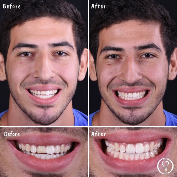 Before and after dental work