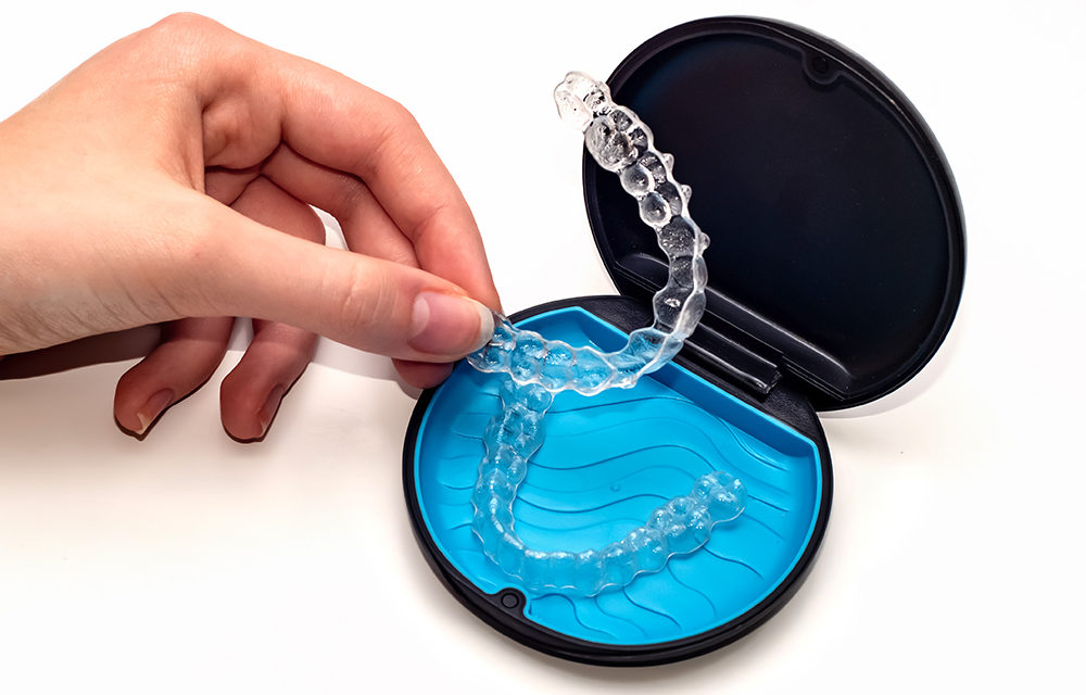Invisalign teeth aligners as an alternative to braces