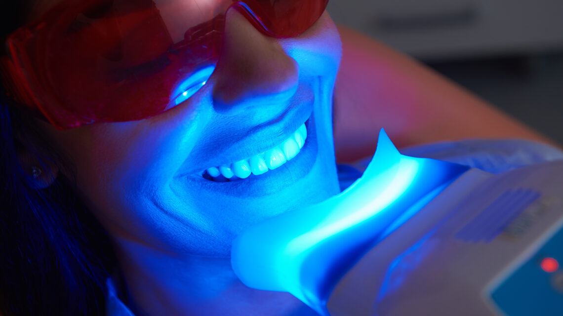 Teeth Whitening: Professional vs. At-Home Options