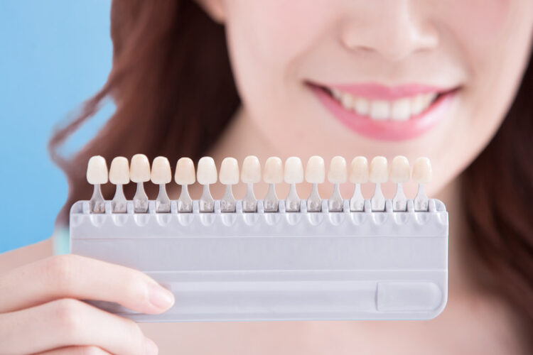 Porcelain Veneers: Your Path to a Radiant Smile
