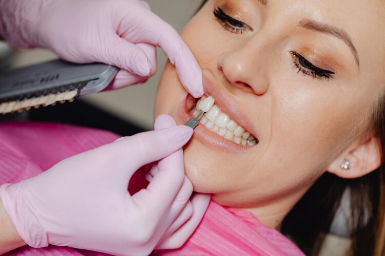 The Complete Veneer Procedure: What to Expect