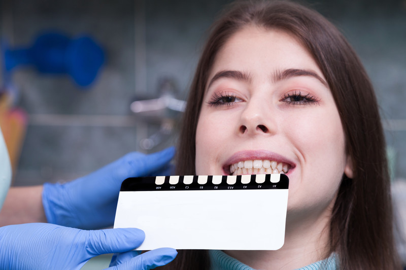 Porcelain vs Composite Veneers: Which Is Best?