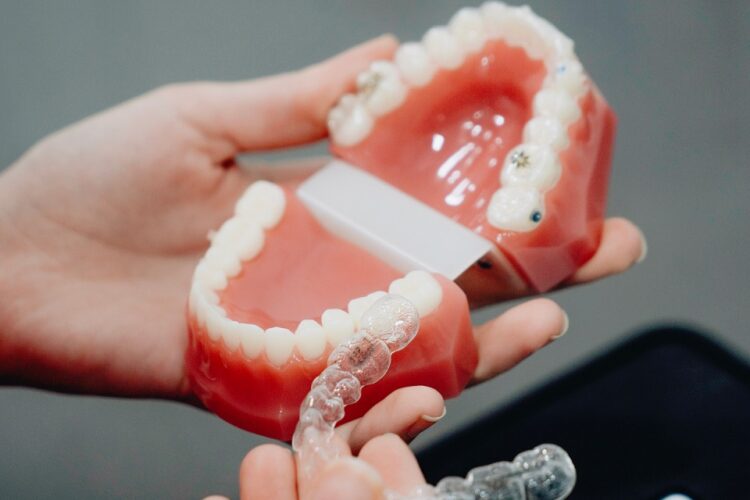 Your Top Invisalign Questions Answered by Dr. Raffoul