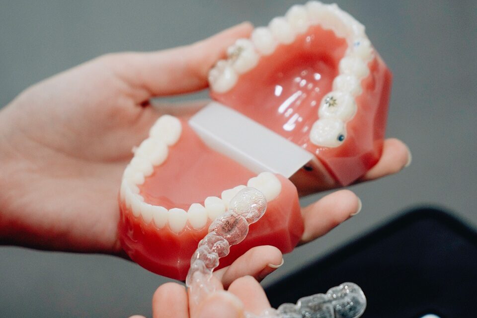 Your Top Invisalign Questions Answered by Dr. Raffoul